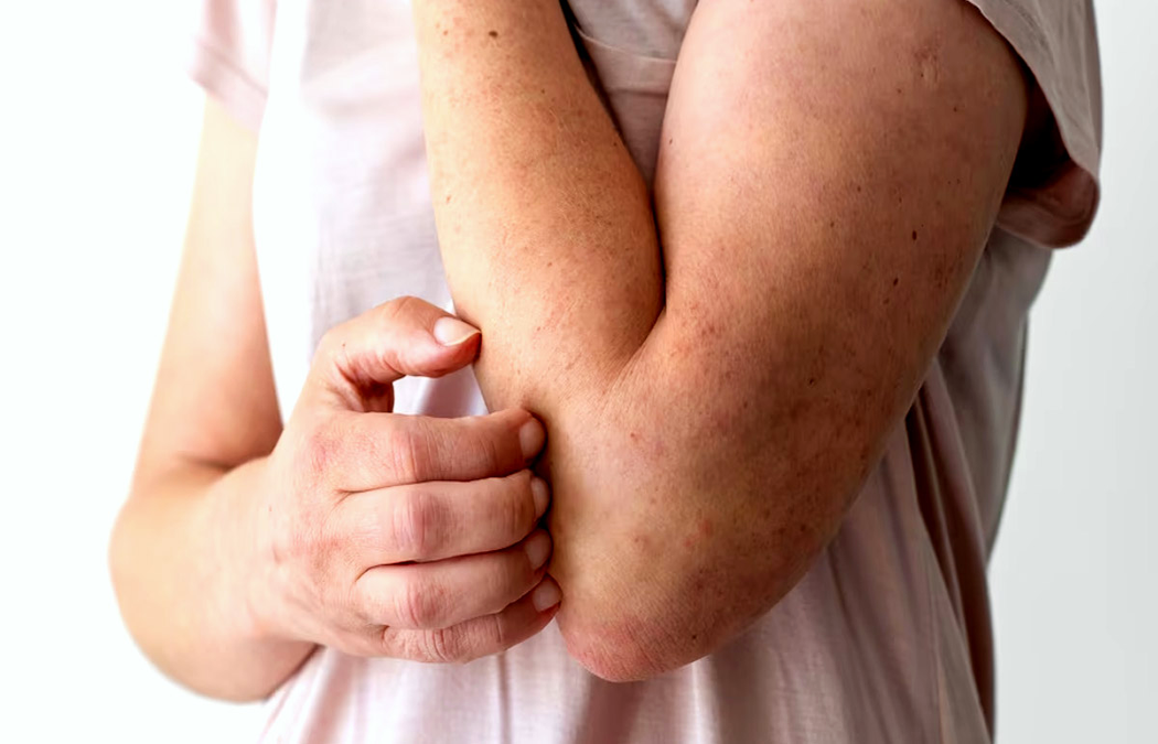 10 Triggers of Inflammation