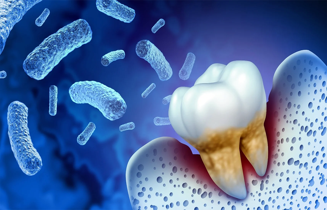Gut health and Periodontal Disease