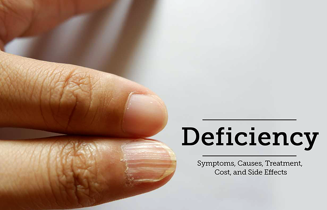 Vitamin and Mineral Deficiencies